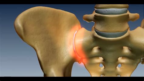 Where is the Sacroiliac Joint? Anatomy of the Sacroilac Joint - YouTube