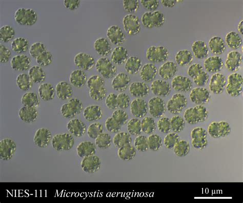 Microcystis aeruginosa Kützing, 1846 Microcystis aeruginosa is a species of freshwater ...