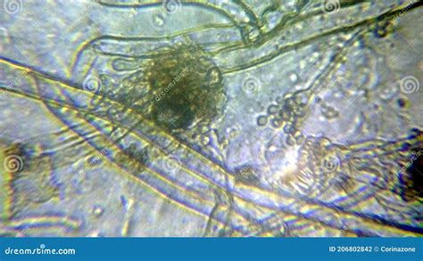 Aspergillus Niger the Black Mold Conidia Under the Microscope Stock Photo - Image of aspergillus ...