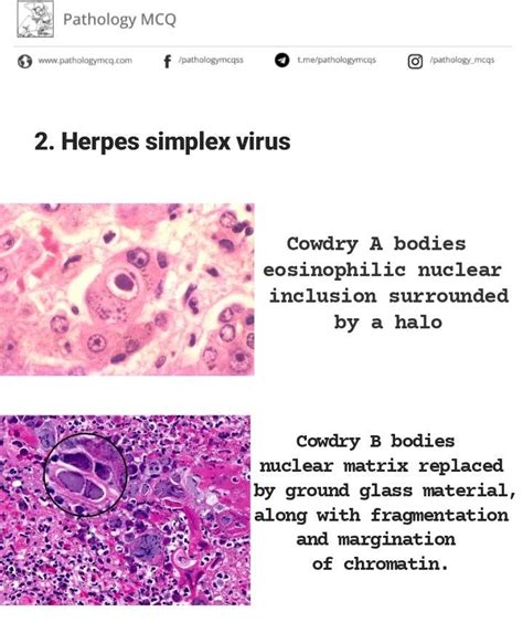 Pathology MCQs for various entrance exams