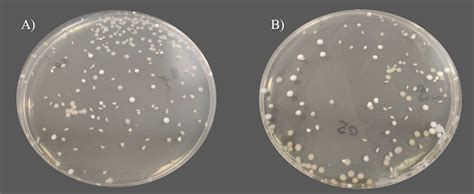 Improvement of the Pour Plate Method by Separate Sterilization of Agar and Other Medium ...