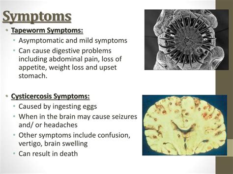 PPT - Parasites: Fish Tapeworm Pork Tapeworm PowerPoint Presentation ...