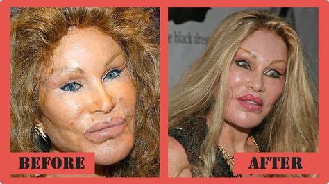 catwoman Plastic Surgery Before and After Catwoman Plastic Surgery # ...