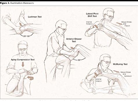 Figure 2 from The rational clinical examination. Does this patient have a torn meniscus or ...