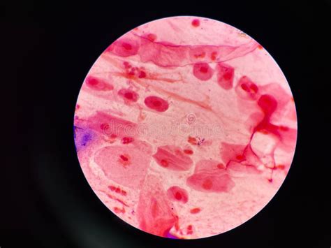 Bacteria Cell in Sputum Sample Gram Stain Method Stock Image - Image of human, gram: 270640267