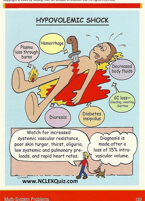 Nursing Pathophysiology Memory NoteCards: Hypovolemic Shock - NCLEX Quiz