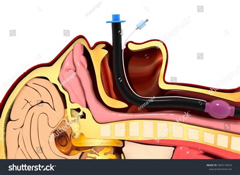 Endotracheal Intubation Anatomy