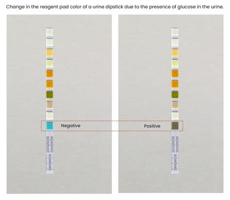 All About Glucose in Urine and Urine Glucose Test Strips