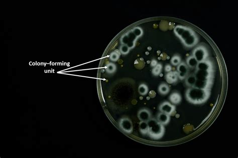 The meaning of cfu/g and how to read a microbial laboratory report