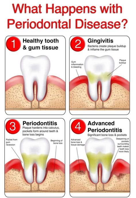 Gum Disease Treatment Leeds | Book Now | Horsforth Smile Clinic