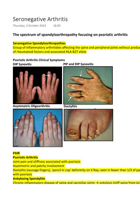 Seronegative Arthritis - The spectrum of spondyloarthropathy focusing on psoriatic arthritis ...