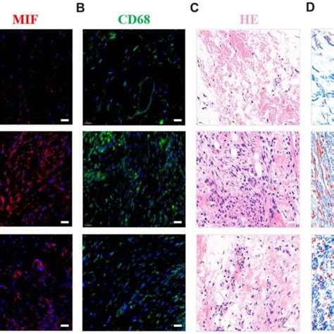 Inhibition of MIF in the lesion area attenuated posterior joint capsule... | Download Scientific ...