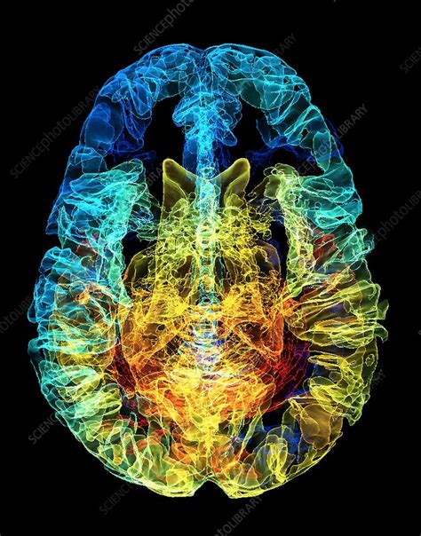 Human brain, 3D MRI scan - Stock Image - C038/6340 - Science Photo Library