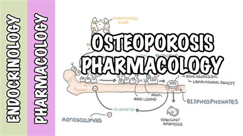 Osteoporosis pharmacology, prevention and treatment (bisphosphonates, denosumab, SERMs) - YouTube