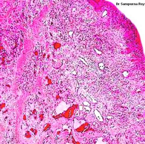 Pin on Systemic Pathology ; Medicine