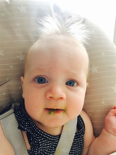 Uncombable Hair Syndrome Is A Real, Super-Rare Genetic Condition And This Baby Has It