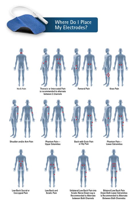 Electrode Placement