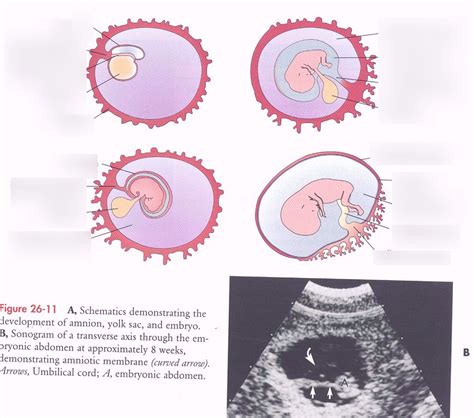 development of amnion, yolk sac, & embryo Diagram | Quizlet