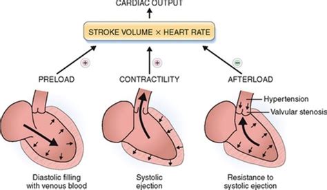 What Is Afterload In The Heart - slidesharetrick