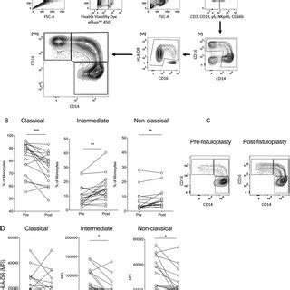 IL-6 and TNF-α following a fistuloplasty procedure. (A) IL-6 levels in... | Download Scientific ...