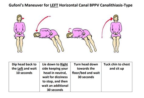 Eply Maneuver Pdf - Epley Maneuver Physical Therapy Physical Therapy Exercises Vertigo Exercises ...