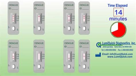 Dengue Antibody IgG / IgM Test - YouTube