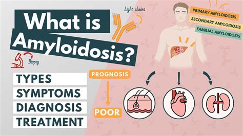 What is Amyloidosis? | Symptoms, Diagnosis, Treatment | Visual ...