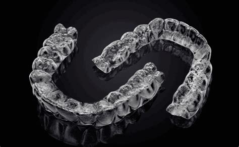 The Benefits of Wearing Aligners: A Comprehensive Guide