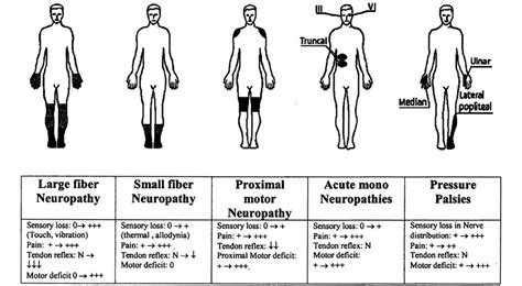 Sensory Polyneuropathy: All You Need To Know | Neuropathy and HIV