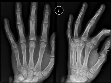 Medical X-rays – Radiological Imaging From Film to Digital X-rays