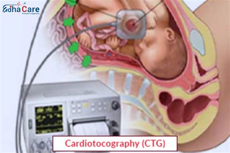 Cardiotocography (CTG) for Pregnancy : Treatment And Procedure