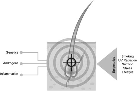 The most recognized causes of androgenetic alopecia. In the left of the... | Download Scientific ...