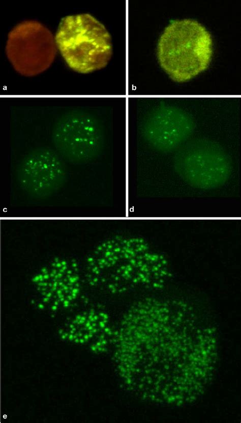 Peptide nucleic acid (PNA) probe and DNA staining of human... | Download Scientific Diagram