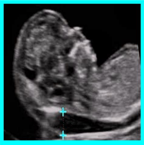 OB-GYN Ultrasound - Test & Learn Quiz | All About Ultrasound