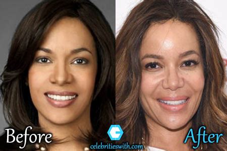 Sunny Hostin Plastic Surgery, Nose Job, Botox, Before After Pictures - CelebritiesWith.com