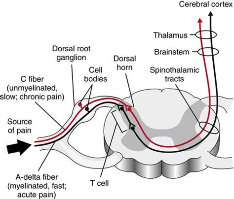 Pain | Musculoskeletal Key