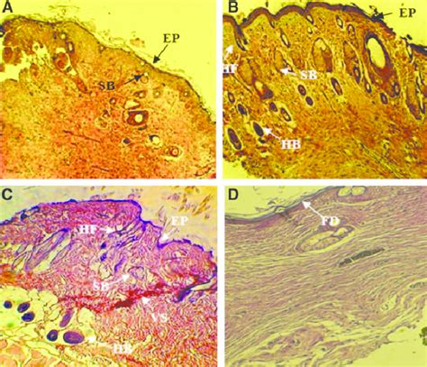 Histology of wounds by hematoxylin and eosin staining in the different... | Download Scientific ...