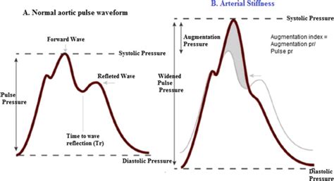 Hemodynamic changes in arterial stiffness; (A) In normal aortic pulse ...