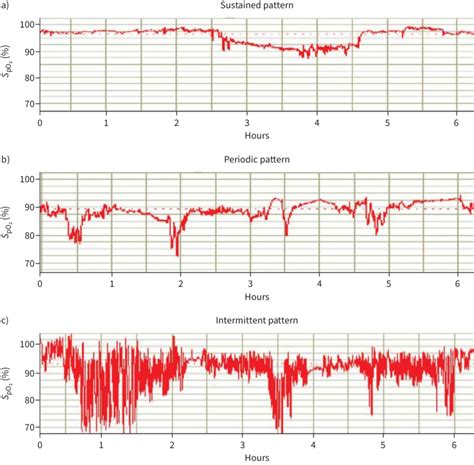 Overnight oximetry patterns: a) sustained, b) periodic and c)... | Download Scientific Diagram