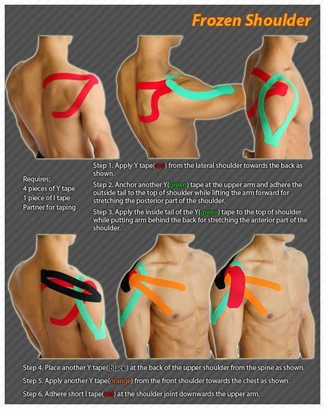 Kinesiology taping instructions for frozen shoulder #ktape #frozenshoulder #ares | Shoulder ...