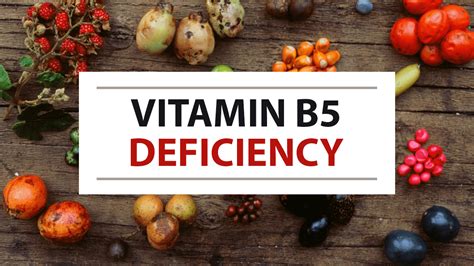 Pin on Vitamins:Sources, Benefits and Deficiency