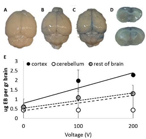 Results of the Evans blue (EB) extravasation experiments. (A) A brain... | Download Scientific ...