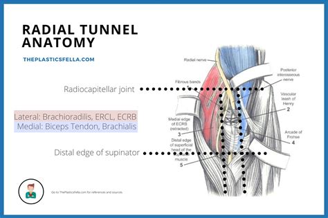 Posterior Interosseous Nerve Syndrome/Palsy - Illustrations, Videos