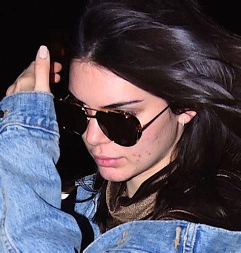 Acne Attack! Makeup-Free Kendall Jenner Tries To Hide Major Breakout