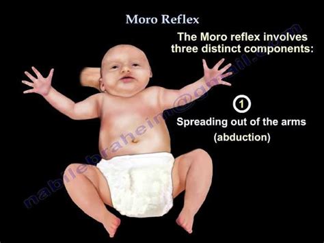 Moro Reflex - Everything You Need To Know - Dr. Nabil Ebraheim