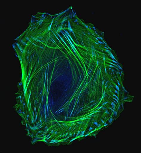 Compartmental function and modulation of the striatum – Young Investigators Review