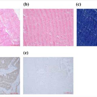 (PDF) Porcine bone-patellar tendon-bone xenograft in a caprine model of ...