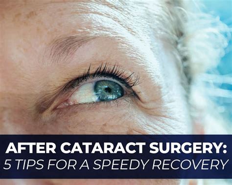 After Cataract Surgery: 5 Tips For a Speedy Recovery | Center for Sight