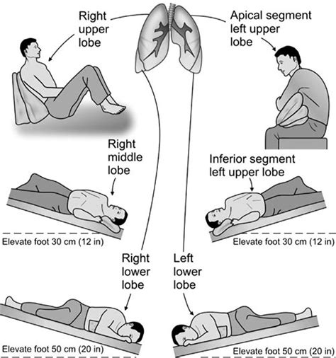 Manual Chest Physiotherapy