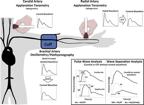 Carotid Pulse Wave